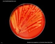 streptococcus on blood agar